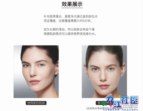 DPLE净肤光能仪效果图